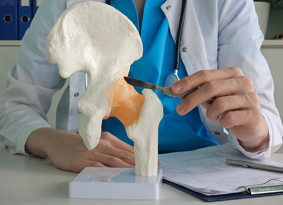 Specialist using a hip model to explain hip pain conditions.