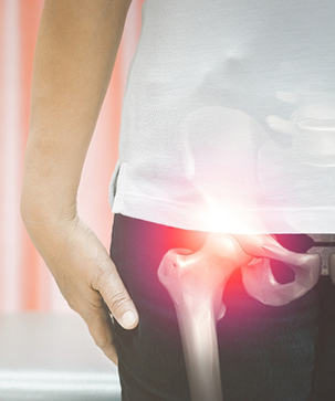 How Arthritis Affects the Hips